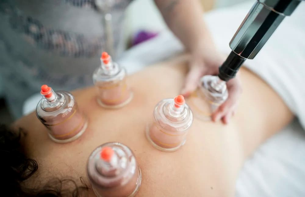 Myofascial cupping